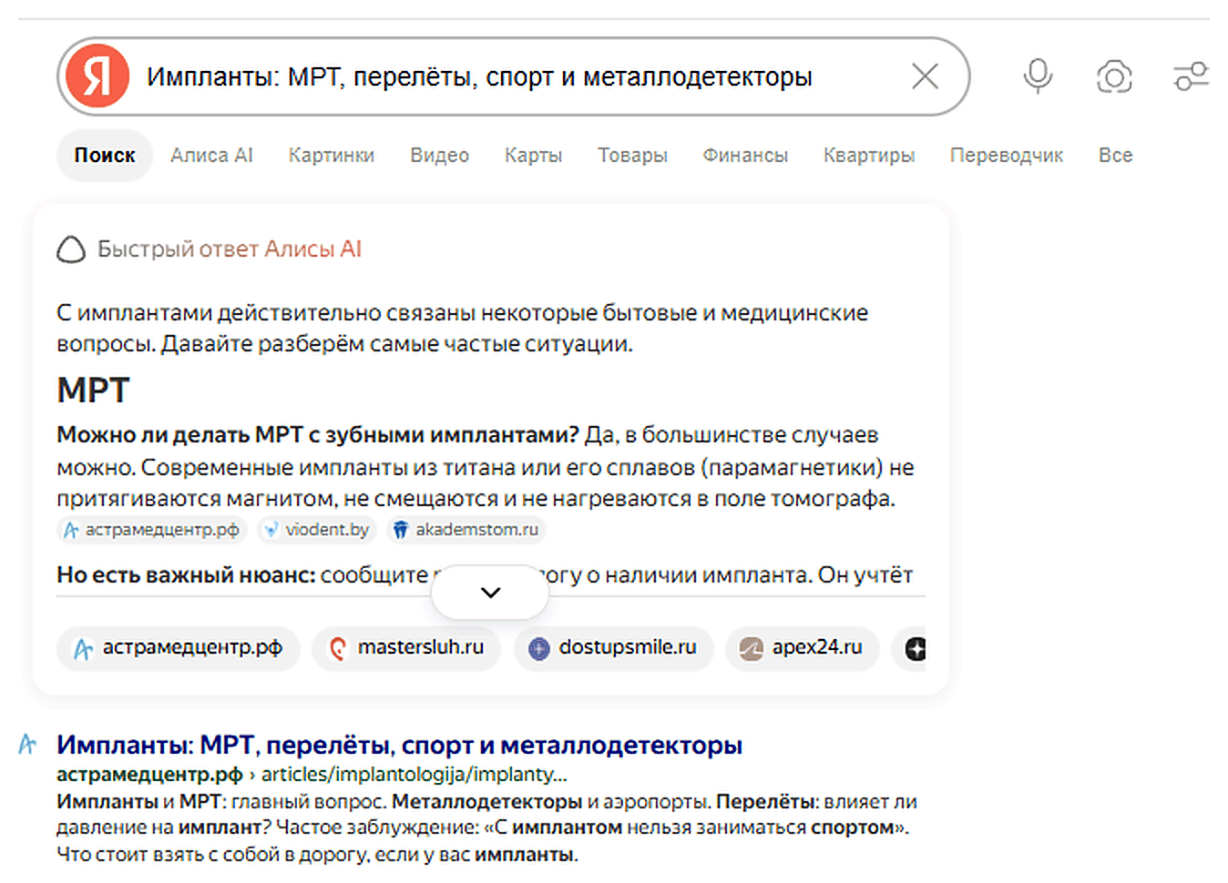 Быстрый ответ Алисы по запросу «импланты: МРТ, перелёты, спорт и металлодетекторы» — среди источников астрамедцентр.рф